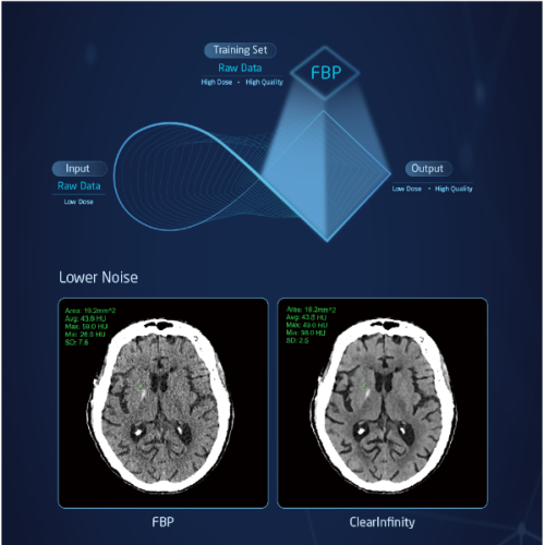 PET CT Scan Machine