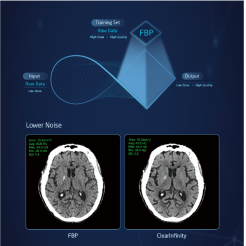 128 Slice CT Scanner